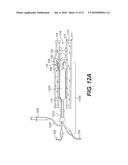 ENDOVASCULAR DEVICES AND METHODS FOR EXPLOITING INTRAMURAL SPACE diagram and image