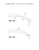 ENDOVASCULAR DEVICES AND METHODS FOR EXPLOITING INTRAMURAL SPACE diagram and image