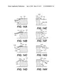 ENDOVASCULAR DEVICES AND METHODS FOR EXPLOITING INTRAMURAL SPACE diagram and image