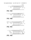 ENDOVASCULAR DEVICES AND METHODS FOR EXPLOITING INTRAMURAL SPACE diagram and image