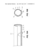 ENDOVASCULAR DEVICES AND METHODS FOR EXPLOITING INTRAMURAL SPACE diagram and image