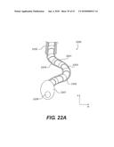 ENDOVASCULAR DEVICES AND METHODS FOR EXPLOITING INTRAMURAL SPACE diagram and image