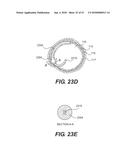 ENDOVASCULAR DEVICES AND METHODS FOR EXPLOITING INTRAMURAL SPACE diagram and image