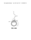 ENDOVASCULAR DEVICES AND METHODS FOR EXPLOITING INTRAMURAL SPACE diagram and image