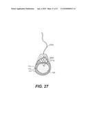 ENDOVASCULAR DEVICES AND METHODS FOR EXPLOITING INTRAMURAL SPACE diagram and image