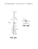 ENDOVASCULAR DEVICES AND METHODS FOR EXPLOITING INTRAMURAL SPACE diagram and image