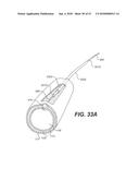 ENDOVASCULAR DEVICES AND METHODS FOR EXPLOITING INTRAMURAL SPACE diagram and image