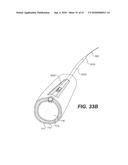 ENDOVASCULAR DEVICES AND METHODS FOR EXPLOITING INTRAMURAL SPACE diagram and image