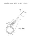 ENDOVASCULAR DEVICES AND METHODS FOR EXPLOITING INTRAMURAL SPACE diagram and image