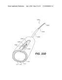 ENDOVASCULAR DEVICES AND METHODS FOR EXPLOITING INTRAMURAL SPACE diagram and image