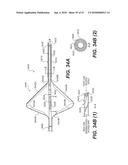 ENDOVASCULAR DEVICES AND METHODS FOR EXPLOITING INTRAMURAL SPACE diagram and image