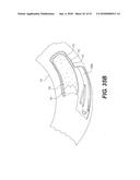 ENDOVASCULAR DEVICES AND METHODS FOR EXPLOITING INTRAMURAL SPACE diagram and image