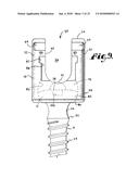 POLYAXIAL BONE SCREW WITH SHANK ARTICULATION PRESSURE INSERT AND METHOD diagram and image