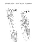 POLYAXIAL BONE SCREW WITH SHANK ARTICULATION PRESSURE INSERT AND METHOD diagram and image