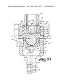 POLYAXIAL BONE SCREW WITH SHANK ARTICULATION PRESSURE INSERT AND METHOD diagram and image