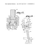 POLYAXIAL BONE SCREW WITH SHANK ARTICULATION PRESSURE INSERT AND METHOD diagram and image