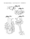 POLYAXIAL BONE SCREW WITH SHANK ARTICULATION PRESSURE INSERT AND METHOD diagram and image