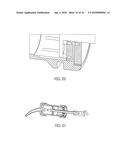 DENTAL MATERIAL DELIVERY SYSTEM diagram and image