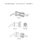 DENTAL MATERIAL DELIVERY SYSTEM diagram and image