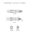 DENTAL MATERIAL DELIVERY SYSTEM diagram and image