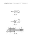 DENTAL MATERIAL DELIVERY SYSTEM diagram and image