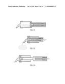 DENTAL MATERIAL DELIVERY SYSTEM diagram and image