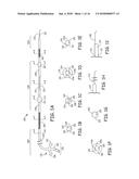 AORTIC ARCH FILTRATION CATHETER FOR CAROTID ARTERY PROTECTION AND METHODS     OF USE diagram and image