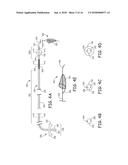 AORTIC ARCH FILTRATION CATHETER FOR CAROTID ARTERY PROTECTION AND METHODS     OF USE diagram and image