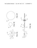 AORTIC ARCH FILTRATION CATHETER FOR CAROTID ARTERY PROTECTION AND METHODS     OF USE diagram and image