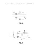 Inflatable Transcatheter Intracardiac Devices And Methods For Treating     Incompetent Atrioventricular Valves diagram and image