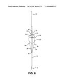 Inflatable Transcatheter Intracardiac Devices And Methods For Treating     Incompetent Atrioventricular Valves diagram and image