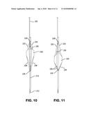 Inflatable Transcatheter Intracardiac Devices And Methods For Treating     Incompetent Atrioventricular Valves diagram and image