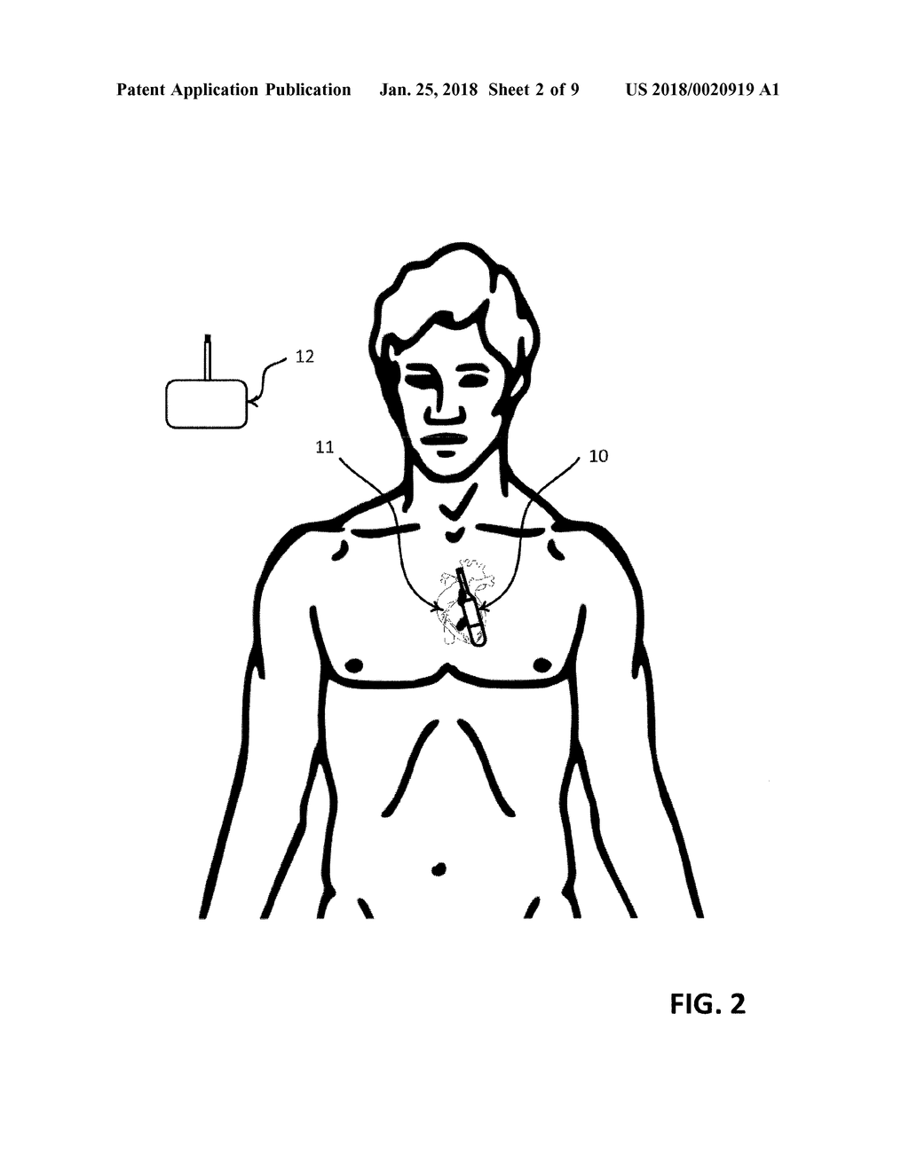 IMPLANTABLE MEDICAL DEVICE SYSTEM - diagram, schematic, and image 03