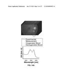 DEVICES, METHODS, AND SYSTEMS OF FUNCTIONAL OPTICAL COHERENCE TOMOGRAPHY diagram and image