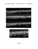 DEVICES, METHODS, AND SYSTEMS OF FUNCTIONAL OPTICAL COHERENCE TOMOGRAPHY diagram and image