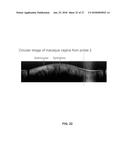 DEVICES, METHODS, AND SYSTEMS OF FUNCTIONAL OPTICAL COHERENCE TOMOGRAPHY diagram and image