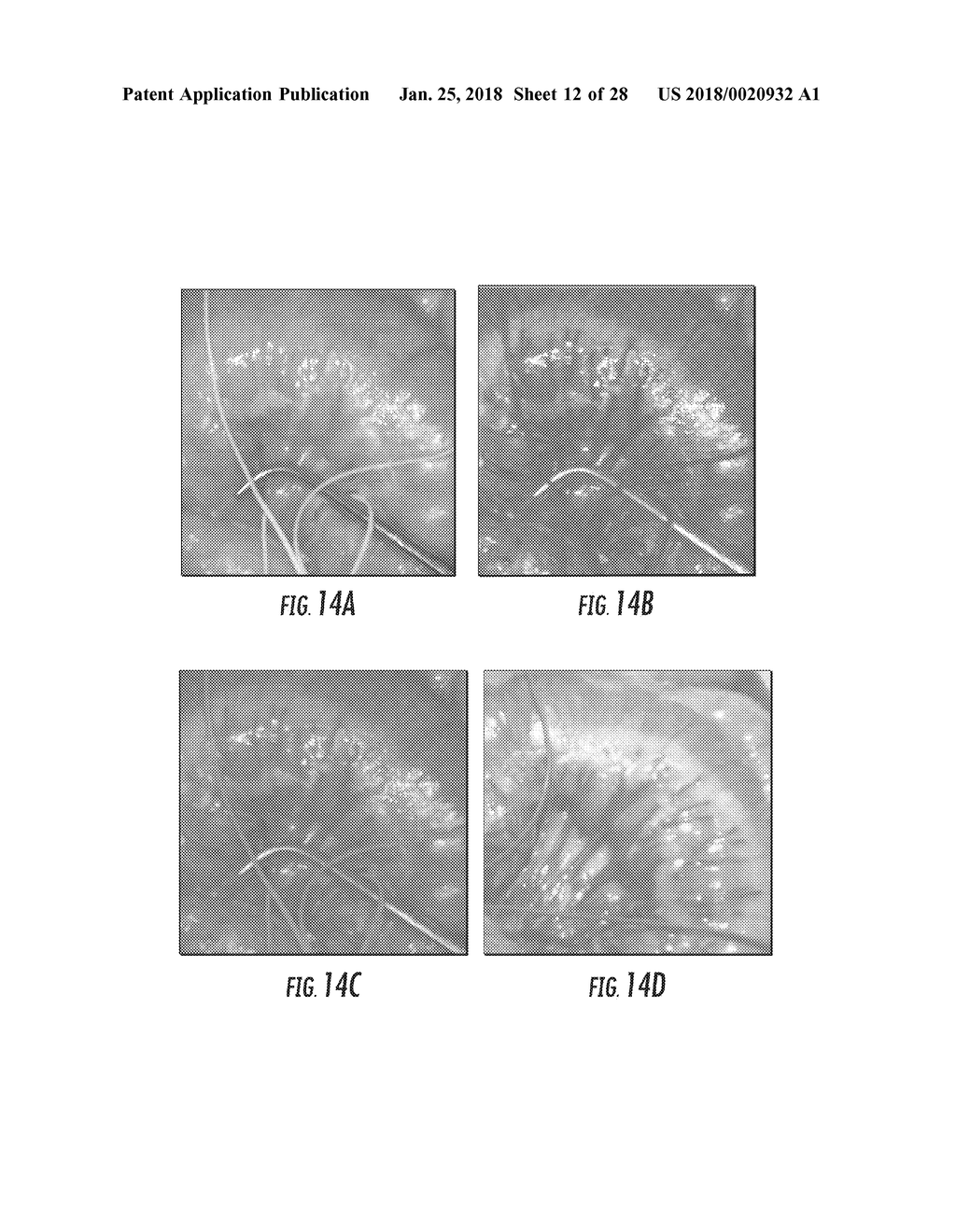 MULTI-SPECTRAL PHYSIOLOGIC VISUALIZATION (MSPV) USING LASER IMAGING     METHODS AND SYSTEMS FOR BLOOD FLOW AND PERFUSION IMAGING AND     QUANTIFICATION IN AN ENDOSCOPIC DESIGN - diagram, schematic, and image 13