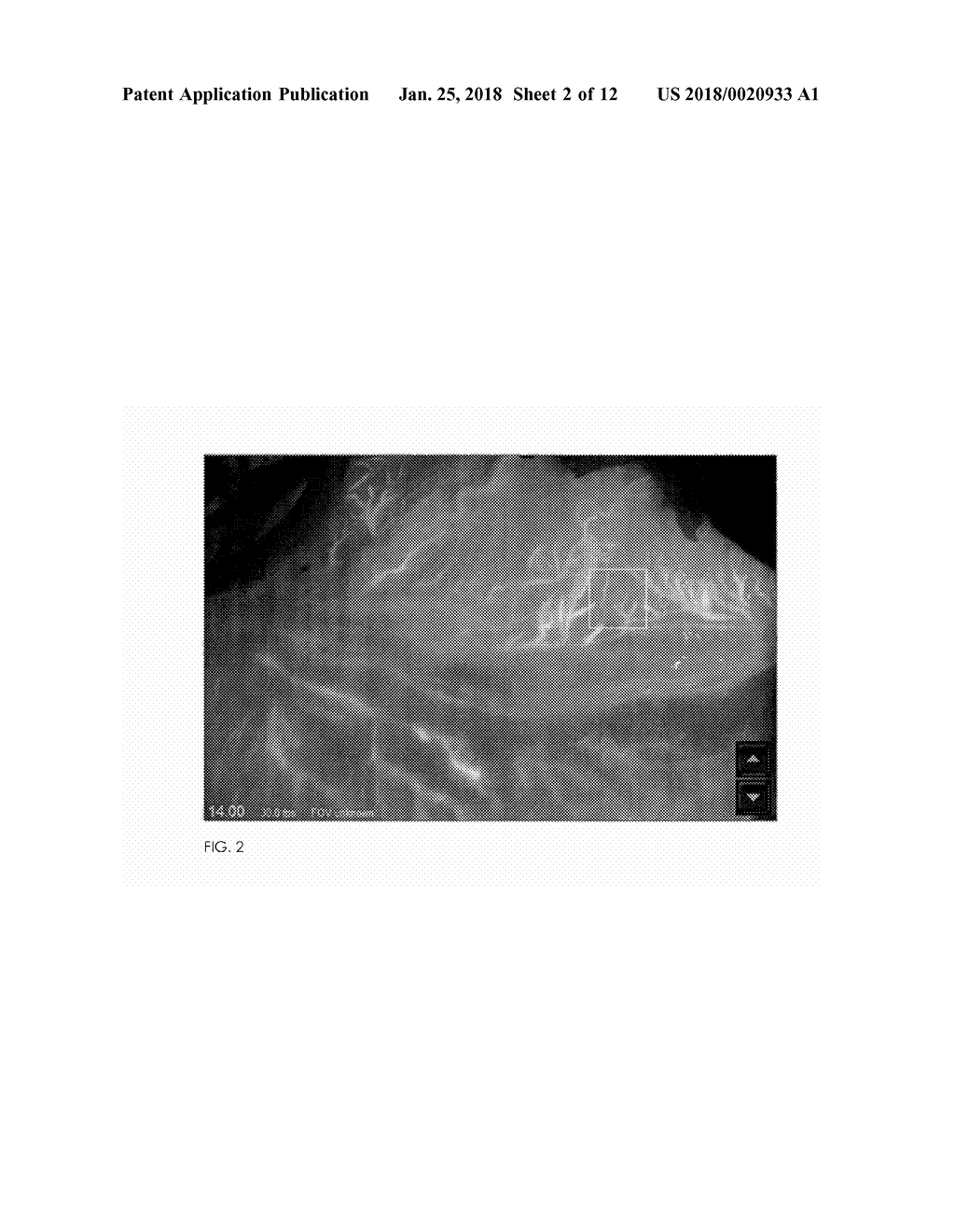 METHOD FOR EVALUATING BLUSH IN MYOCARDIAL TISSUE - diagram, schematic, and image 03