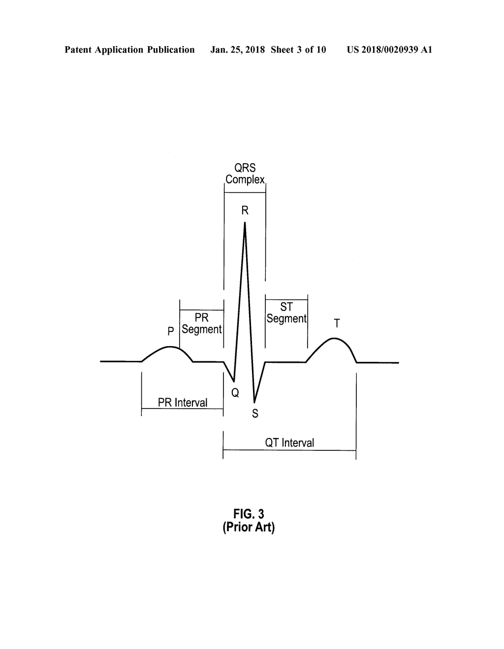 TWO ELECTRODE APPARATUS AND METHODS FOR TWELVE LEAD ECG - diagram, schematic, and image 04