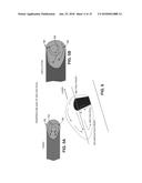 LASER WELDING SYSTEMS FOR ALUMINUM ALLOYS AND METHODS OF LASER WELDING     ALUMINUM ALLOYS diagram and image