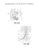 SYSTEM AND METHOD FOR OPTOGENETIC THERAPY diagram and image