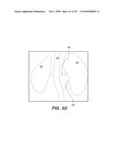 SYSTEM AND METHOD FOR OPTOGENETIC THERAPY diagram and image