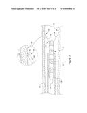 RADIOACTIVE MEDICAL DEVICE diagram and image