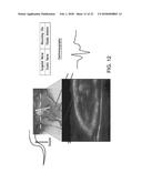 METHODS AND SYSTEMS FOR PERIPHERAL NERVE MODULATION USING FOCUSED     ULTRASOUND diagram and image