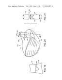 INTERCHANGEABLE SHAFT SYSTEM diagram and image