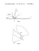 GOLF CLUB HEAD diagram and image