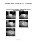 FOAMABLE FORMULATION diagram and image