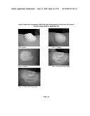 FOAMABLE FORMULATION diagram and image