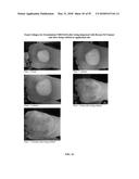 FOAMABLE FORMULATION diagram and image