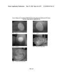 FOAMABLE FORMULATION diagram and image